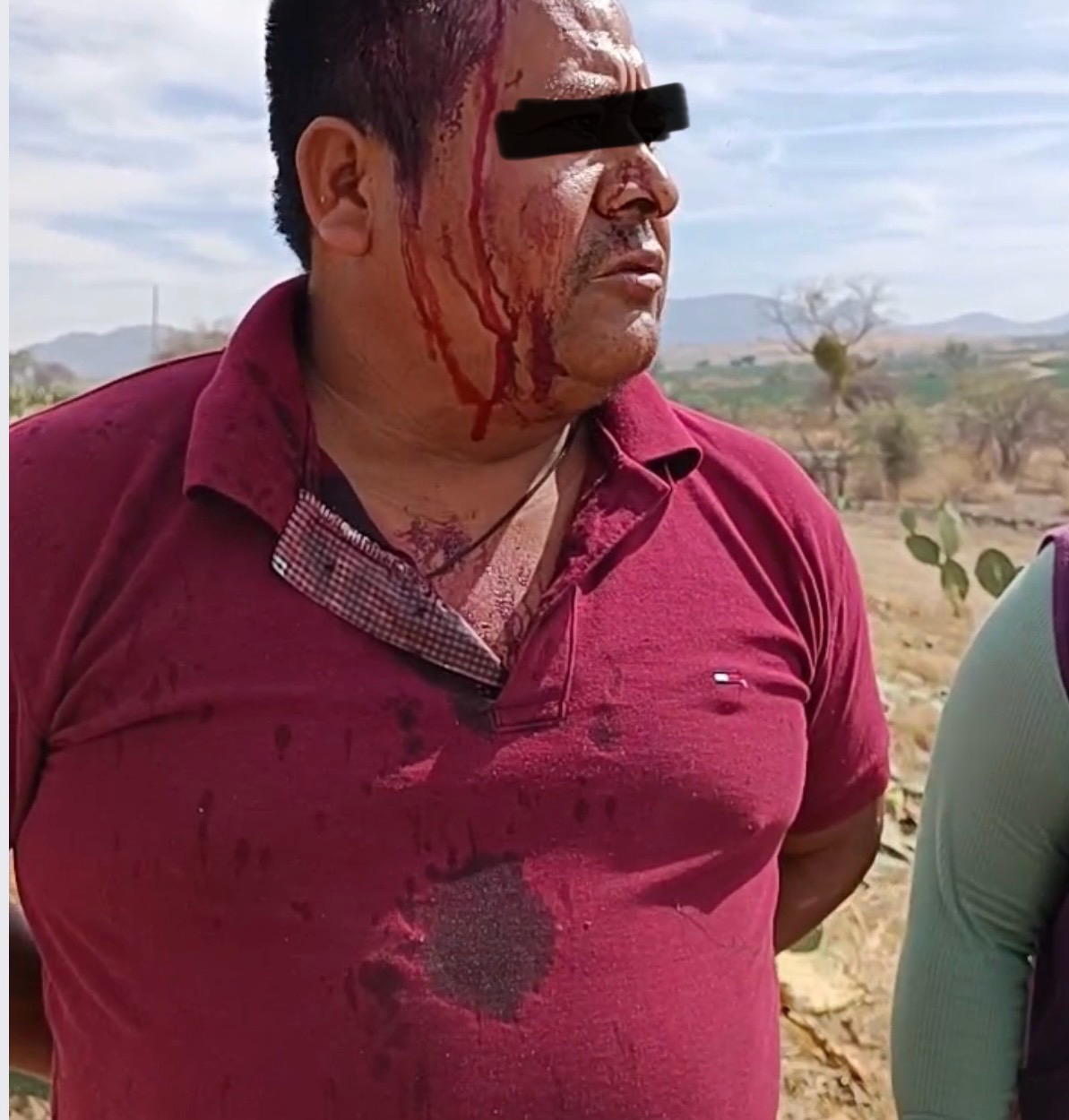 Por un pleito de terrenos machetean a hombre en Santa Isabel Cholula